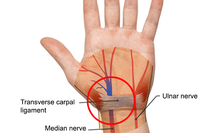 //agapechiro.com/wp-content/uploads/2022/01/carpal-tunnel-syndrome-what-is-it.jpg